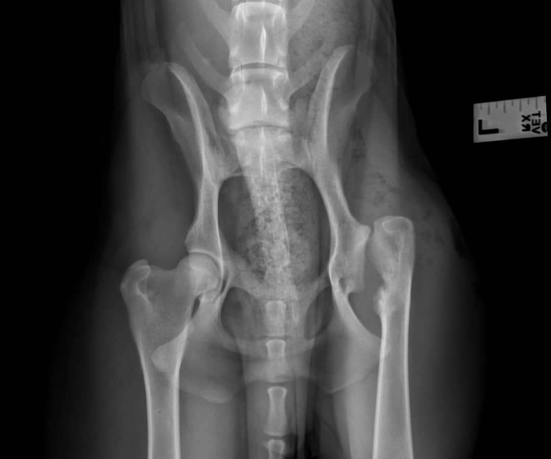 Röntgenaufnahme der Beckenknochen und der oberen Oberschenkelknochen mit einem Maßstab rechts oben.