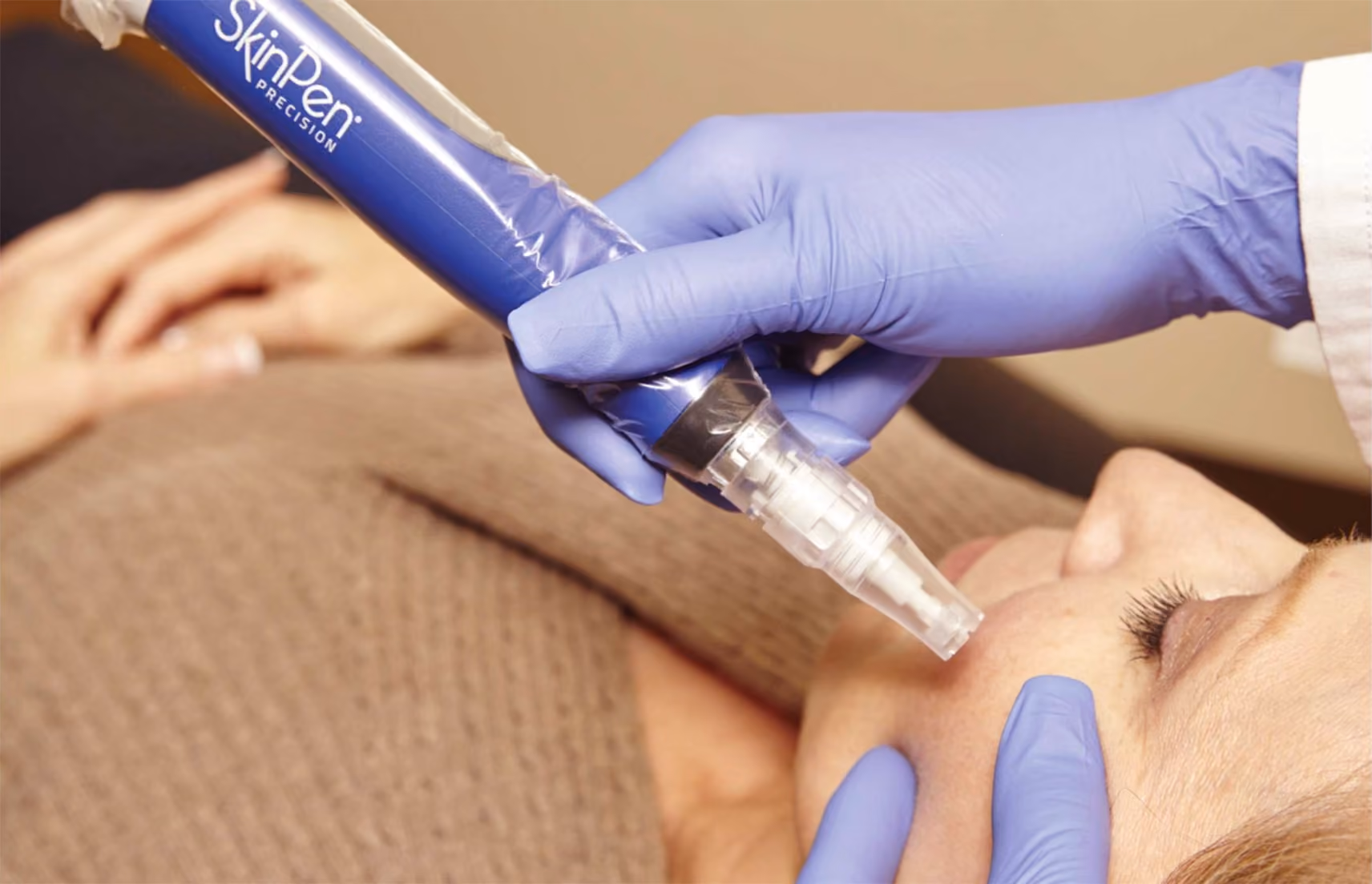 What to Expect After Your SkinPen Microneedling Treatment at Sculpt AZ Medspa — Plus Pro Tips for Maximum Results