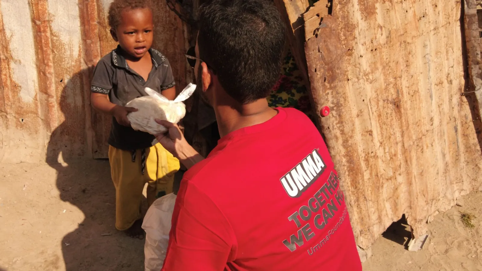 Malnourished child in Yemen facing food crisis and famine