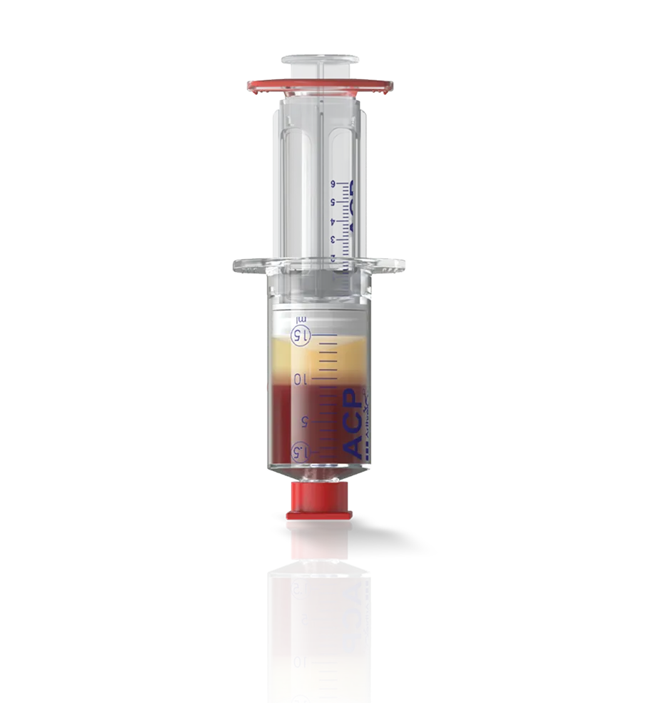 Arthrex ACP® double-syringe system filled with autologous blood components for PRP