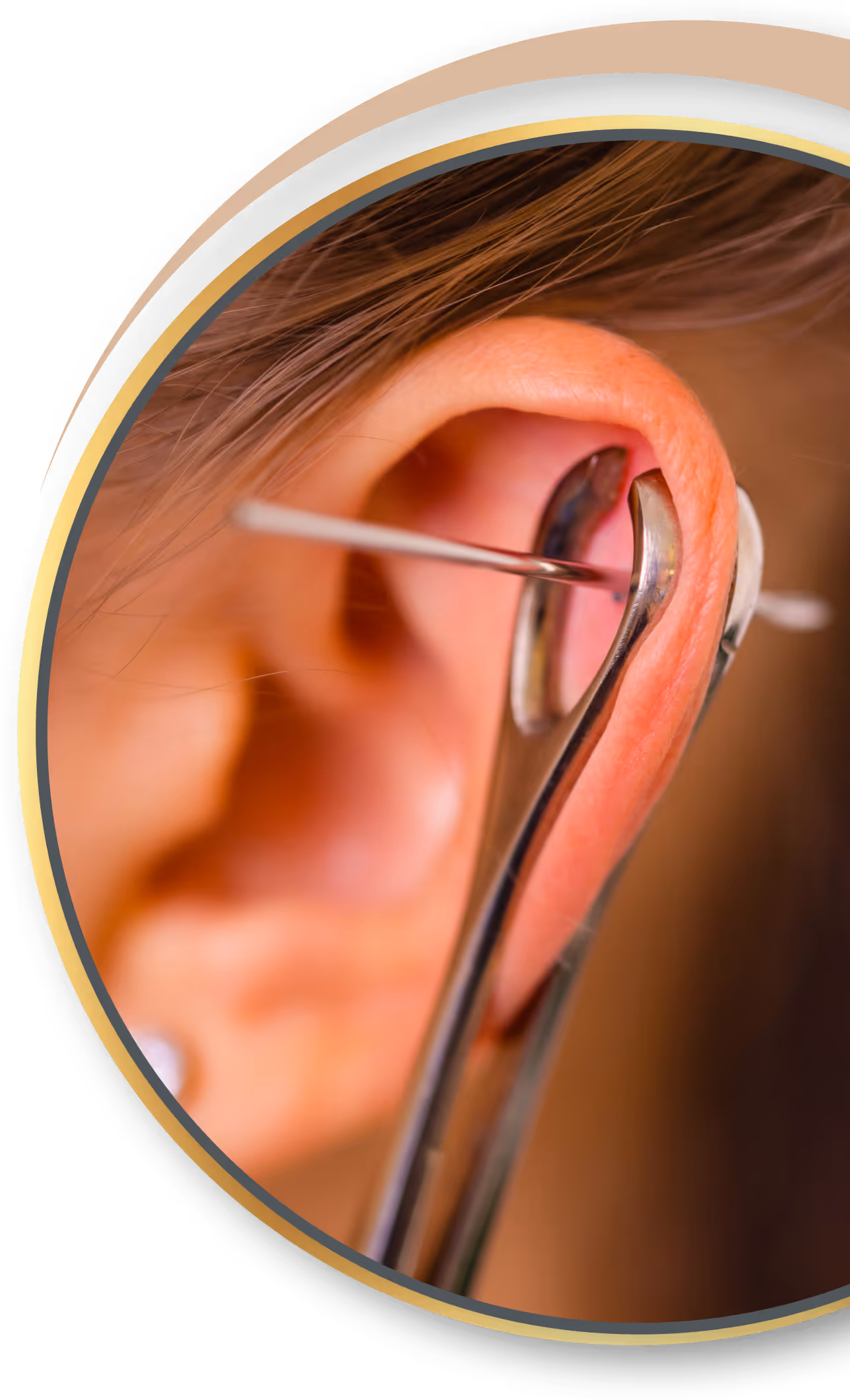 Akupunktur Piercing von Nadelkust für Eschweiler 