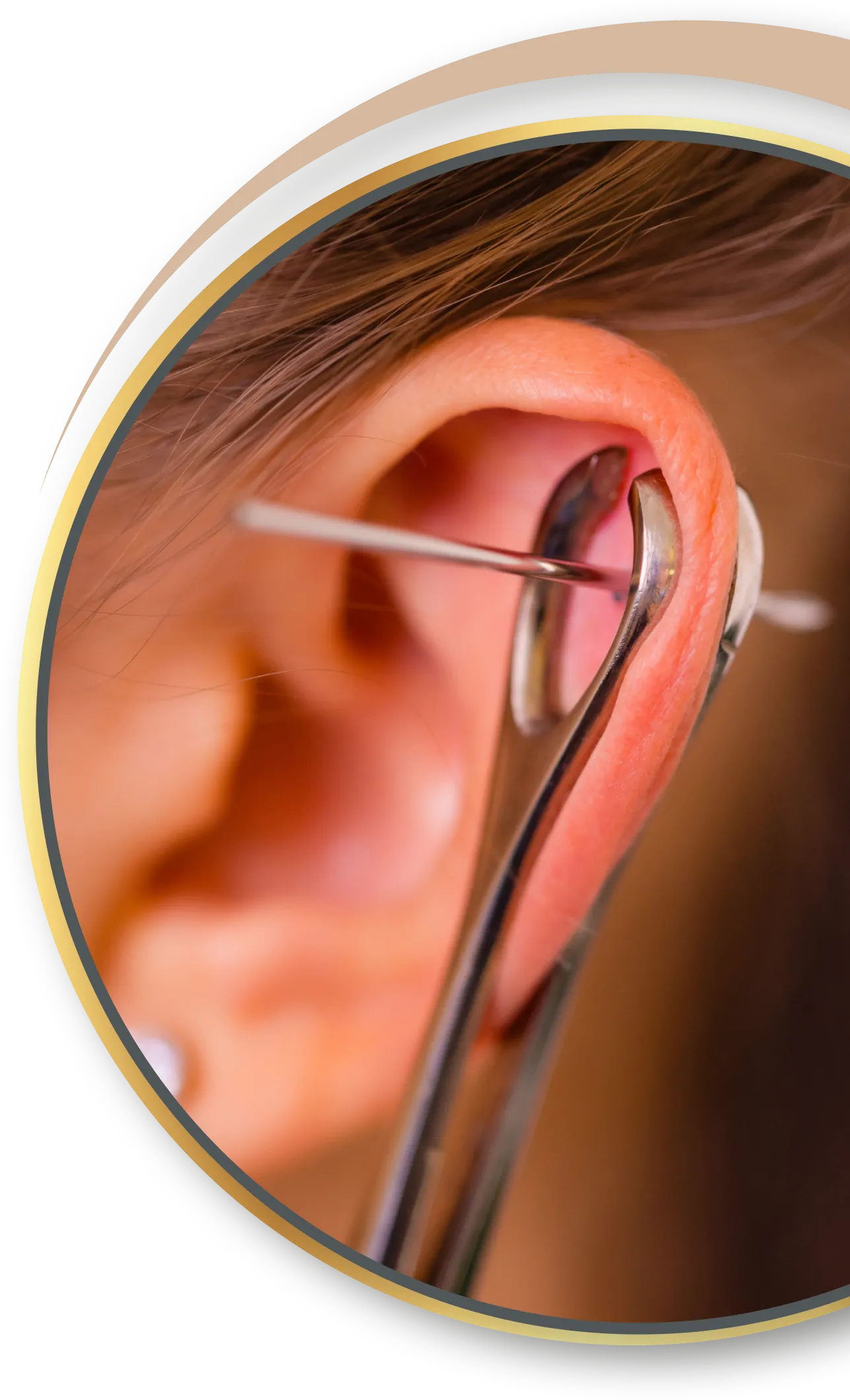 Akupunktur Piercing von Nadelkust für Eupen 