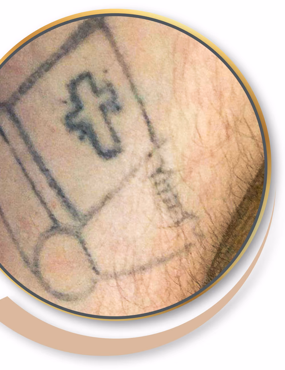Altes Tattoo vor dem Cover-up im Studio Aachen