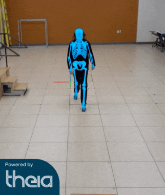 Dynamic markerless motion capture showing knee alignment in a patient with osteoarthritis during walking.