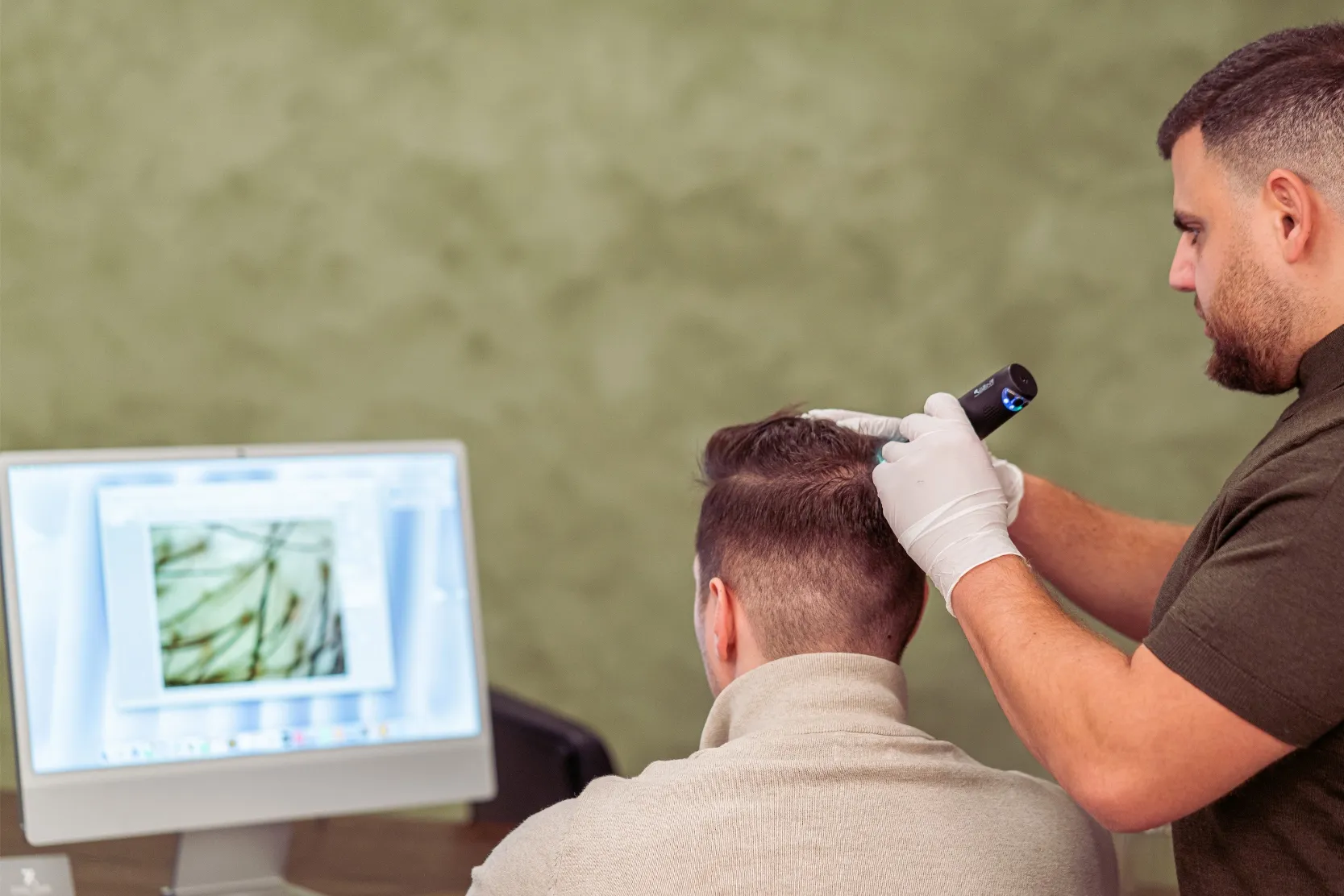 Hårtransplantation mand