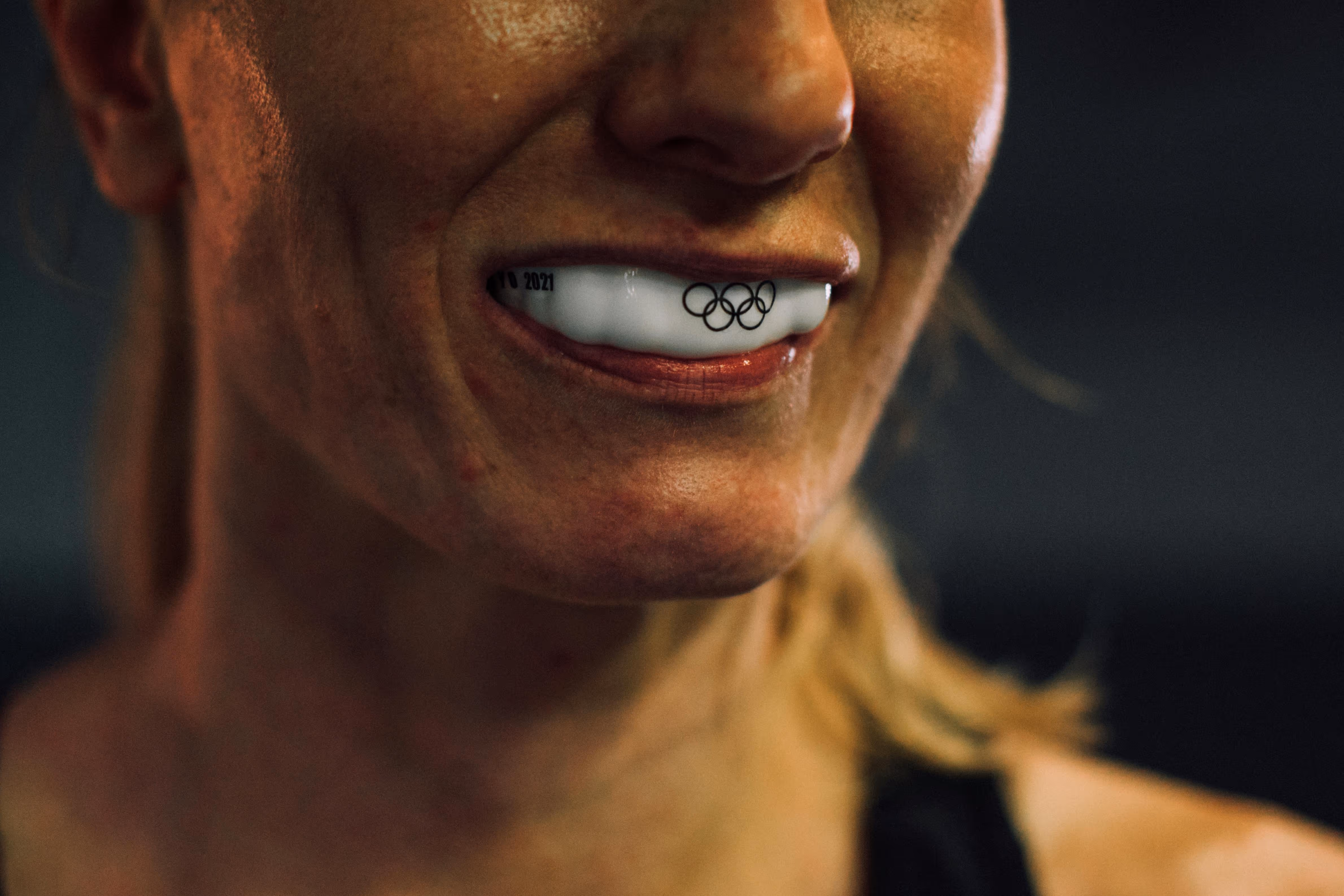 Why Your Child Needs a Custom Mouthguard: Protect Their Smile and Your Wallet