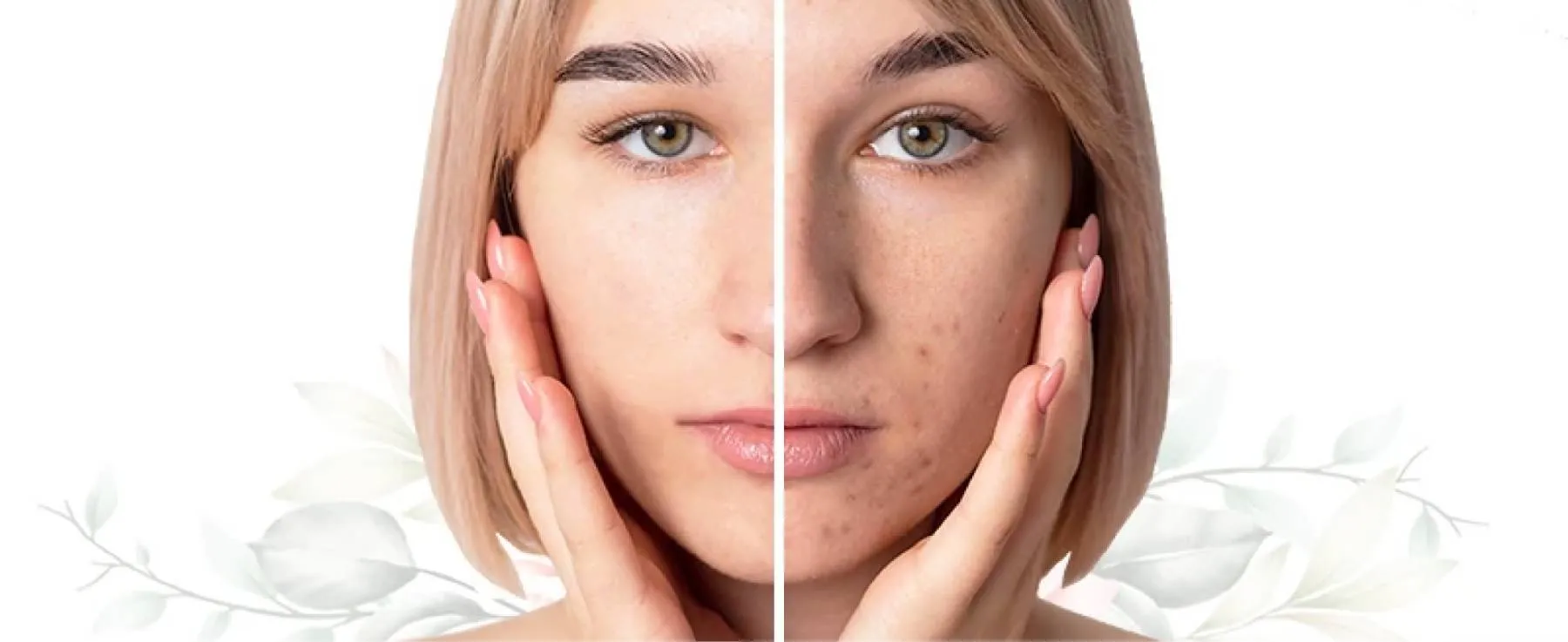 Combining Two Types of Treatments Together