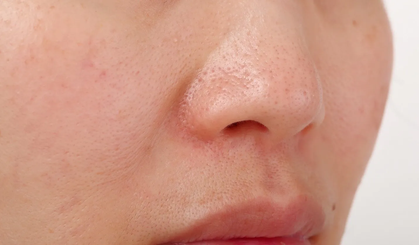 Deep Cleansing Facial