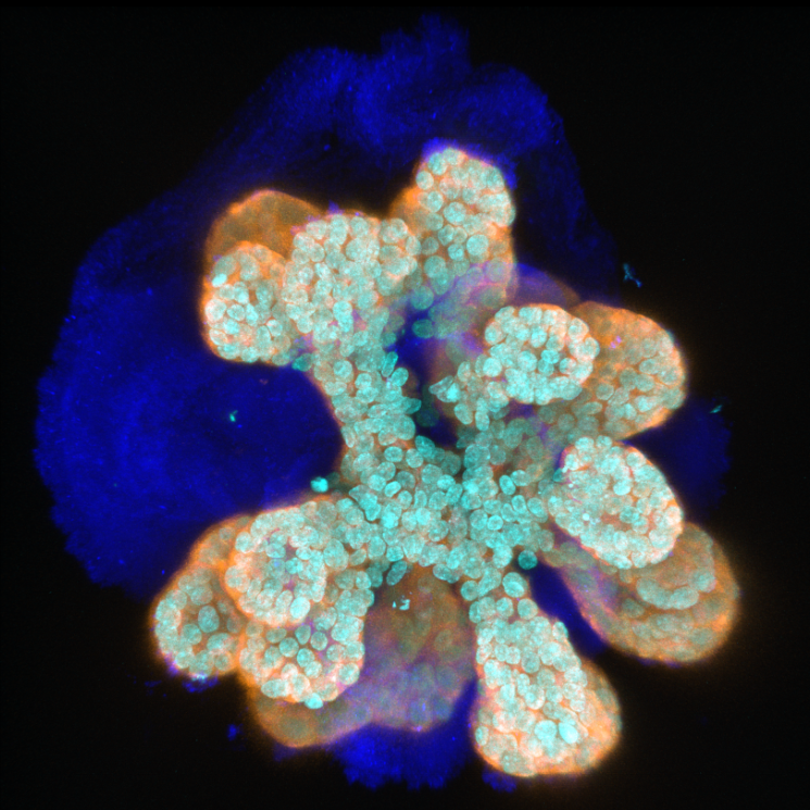 Cancer 3D Tissue Analysis