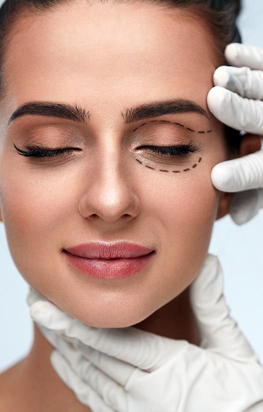 Close-up of a woman's eye showing signs of aging and potential areas for Blepharoplasty treatment to reduce under-eye bags.