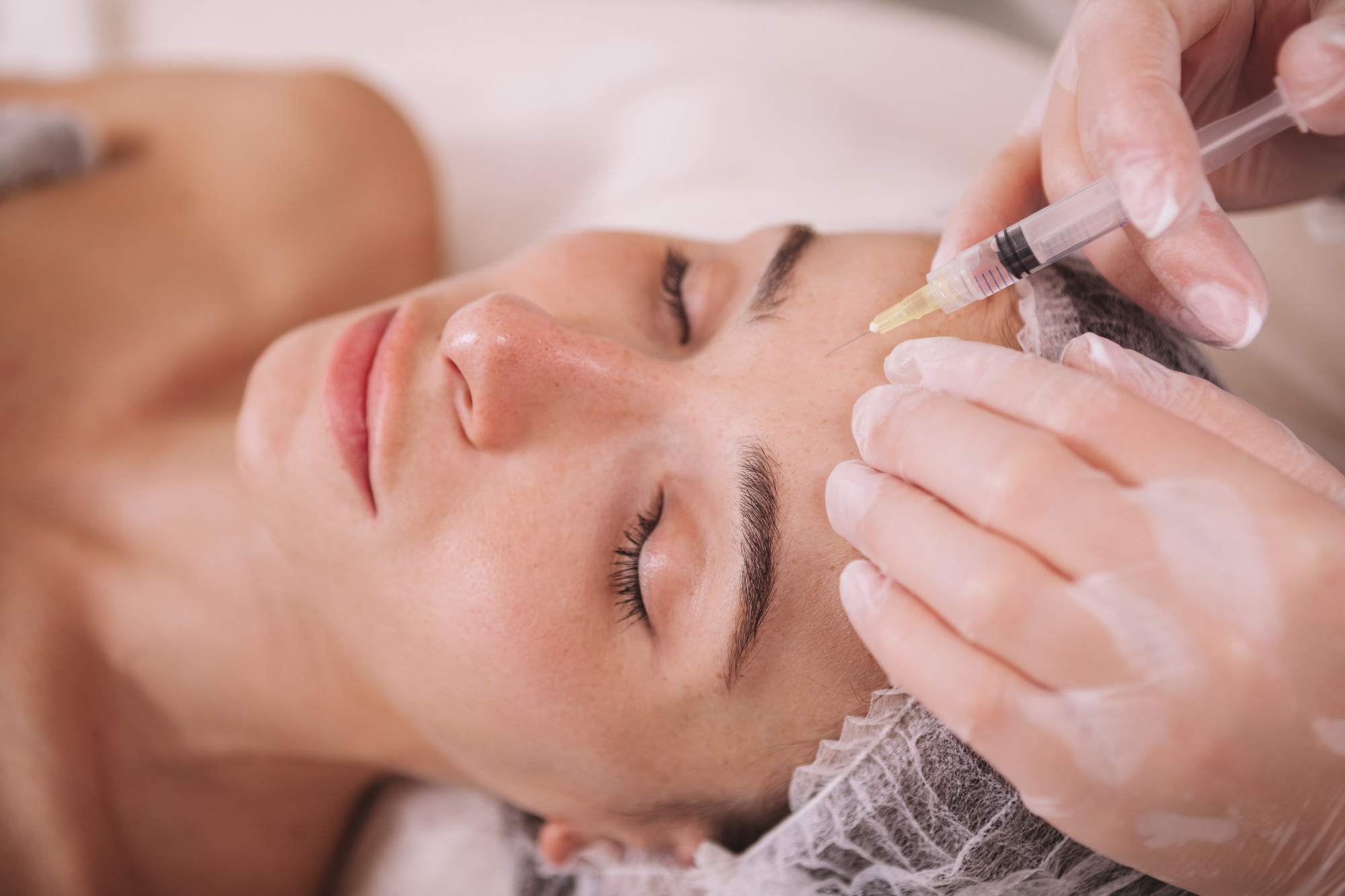 L'injection d'acide hyaluronique réalisée sur le visage par un professionnel en esthétique, visant à restaurer les volumes et à améliorer l’harmonie du visage.