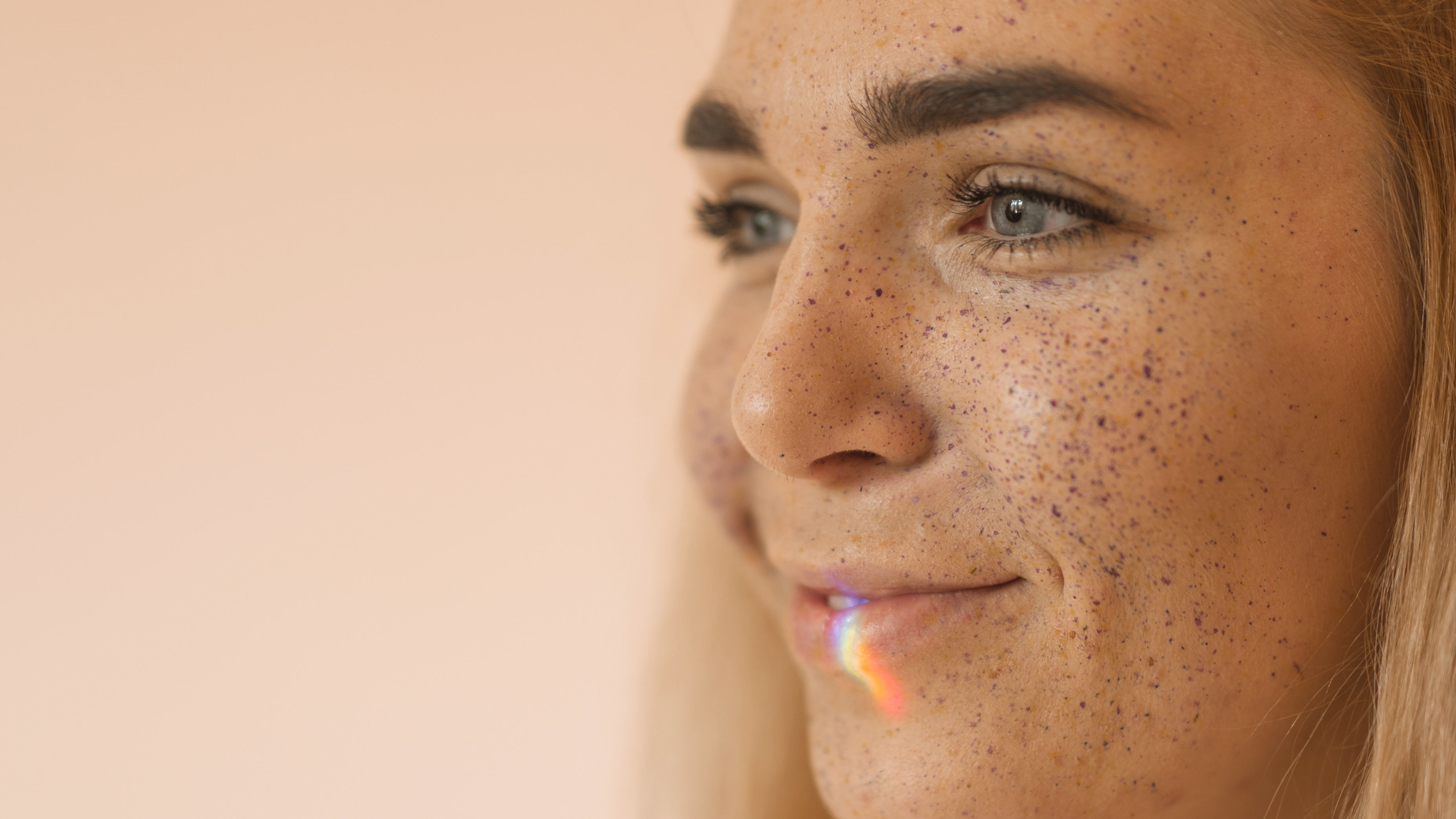 Gros plan du contour des yeux et des pommettes d'une jeune femme au teint clair, zones où les grains de milium apparaissent le plus fréquemment.