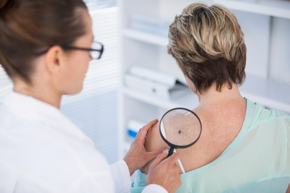 À la Clinique Main d'Or, clinique médico-esthétique de Montréal, chaque lésion est évaluée lors d'une consultation préalable afin de confirmer sa nature bénigne avant tout traitement de kératose séborrhéique. Les professionnels déterminent l'indication et la méthode les plus adaptées en fonction du type, de l'épaisseur et de la localisation de la lésion. Deux techniques sont disponibles en clinique : la cryothérapie et l'électrocoagulation. L'approche est personnalisée et rigoureuse, sans traitement standardisé appliqué sans évaluation préalable individuelle. Conclusion: La kératose séborrhéique ne représente aucun danger pour la santé, mais elle peut causer une gêne esthétique ou physique que rien ne justifie de tolérer indéfiniment. Une consultation avec des professionnels d'une clinique médico-esthétique permet de confirmer le diagnostic et d'orienter vers le traitement le mieux adapté au profil de la lésion. La cryothérapie et l'électrocoagulation sont des solutions rapides, efficaces et non chirurgicales disponibles à Montréal. La kératose séborrhéique est identifiable, traitable et accessible à une prise en charge simple en milieu professionnel.
