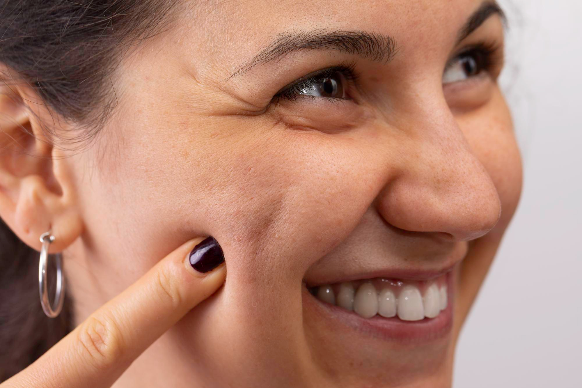Femme souriante pointant du doigt ses pores dilatés sur la joue gauche portant une boucle d'oreille créole argentée brillante.