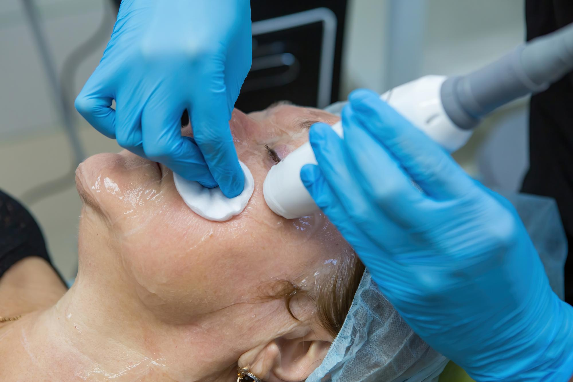 Professionnels en gants bleus effectuant un traitement des pores dilatés au visage avec un appareil médical à ultrasons blanc.