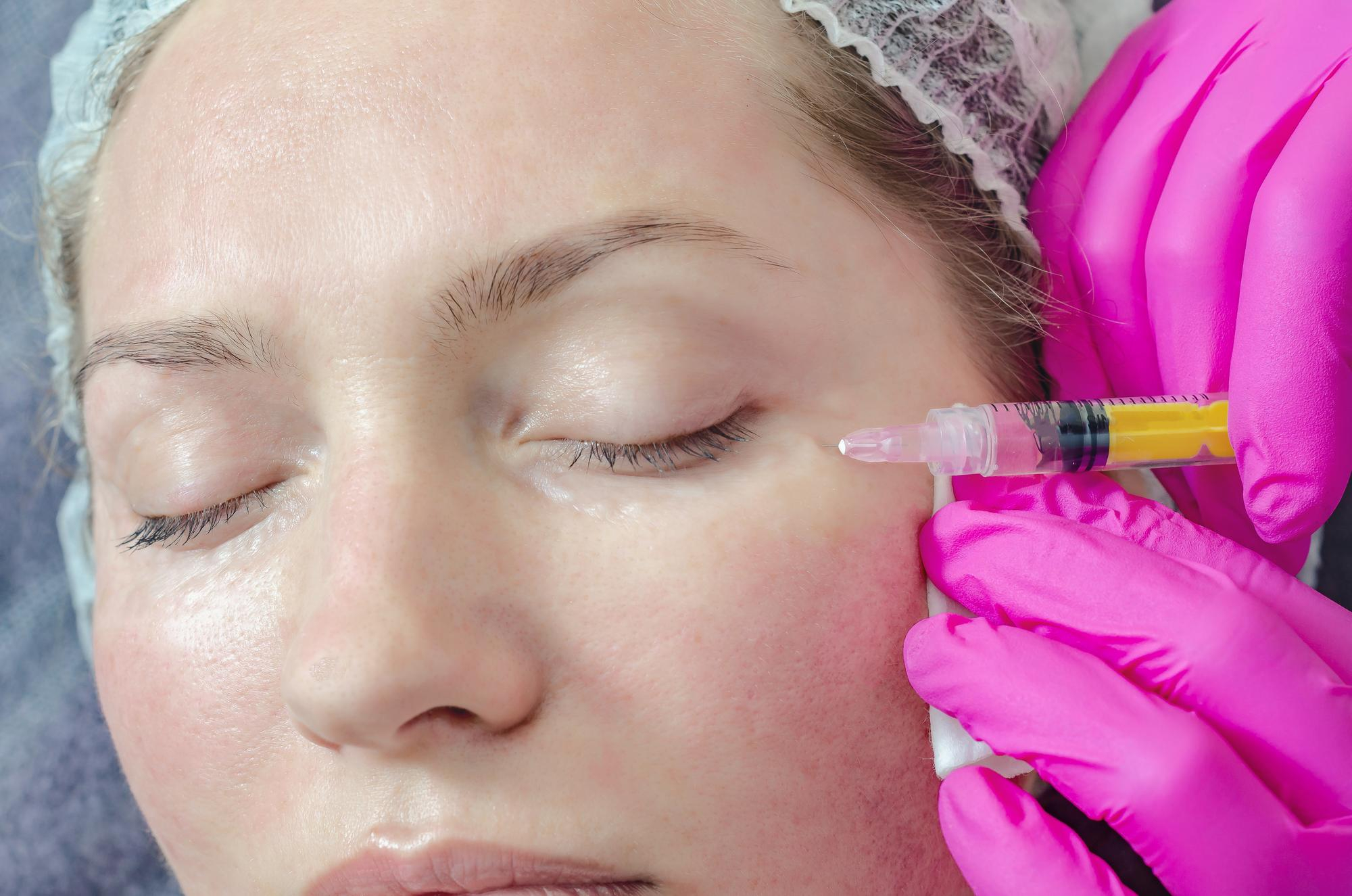 Femme en filet à cheveux recevant une injection Botox ou agents de comblement près de l'œil par professionnel en gants latex.
