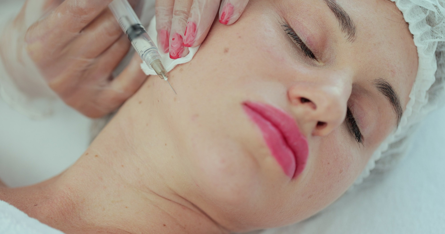 Une main gantée injecte une seringue dans la joue lors d'un traitement des varicosités au visage, cliente allongée, yeux clos.