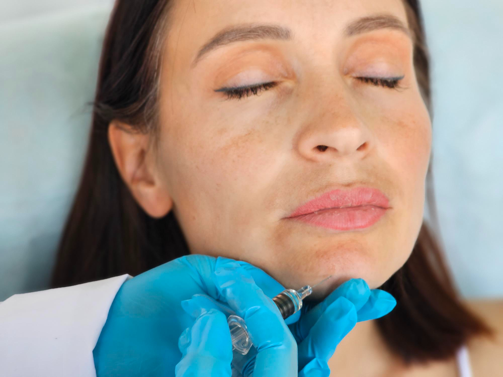 Des mains gantées de bleu injectent une petite seringue de comblement dans le menton d'une femme bien allongée, les yeux clos.