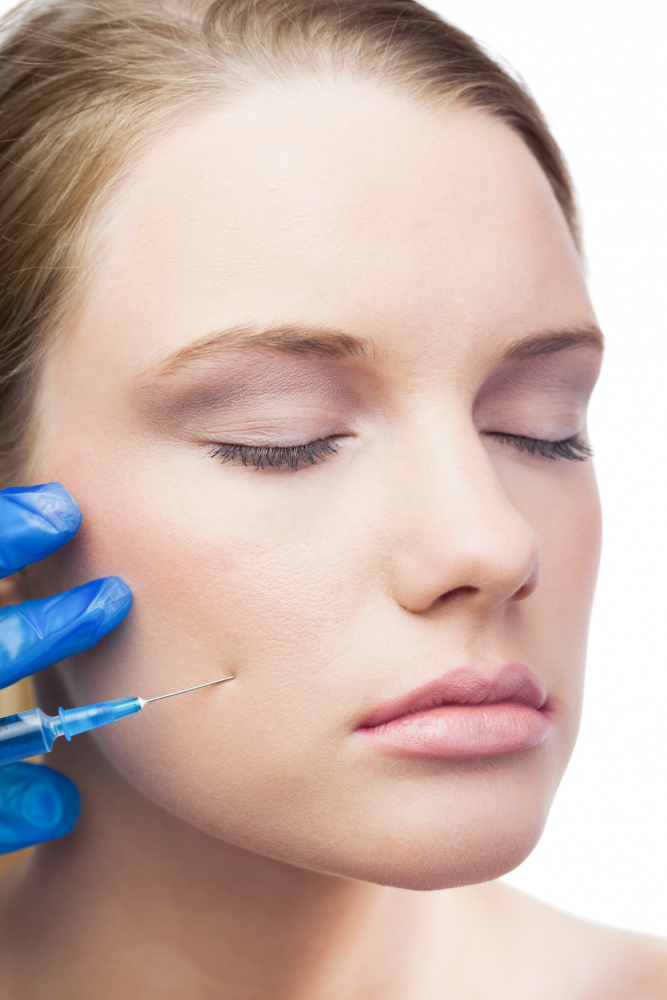 Main gantée effectuant une injection d'acide hyaluronique près de la joue et du sillon nasogénien.
