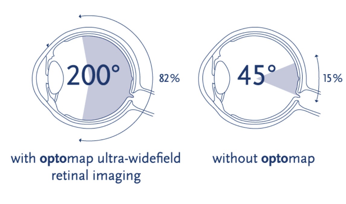 Comparison of retinal imaging field of view with and without Optomap