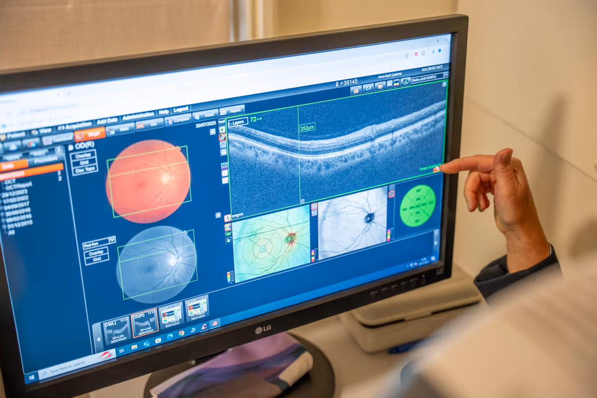 OCT Eye Scan at Hawkes & Wainer