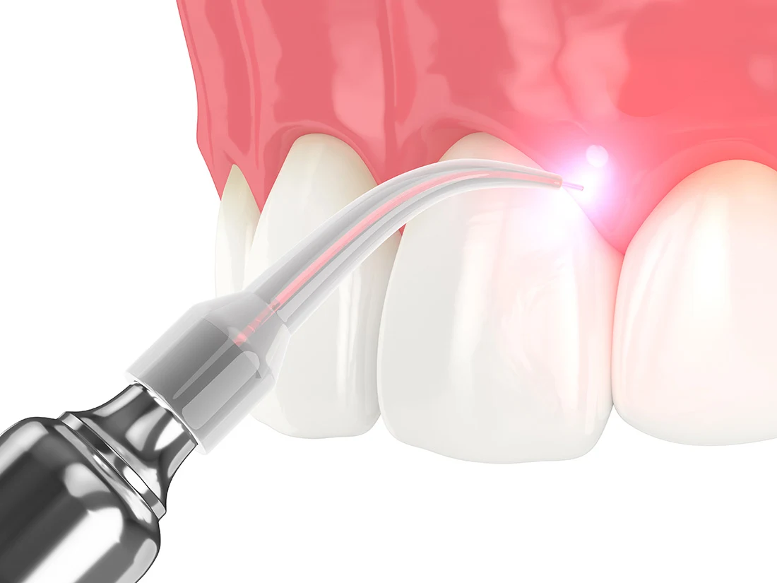 what to expect during digital x rays