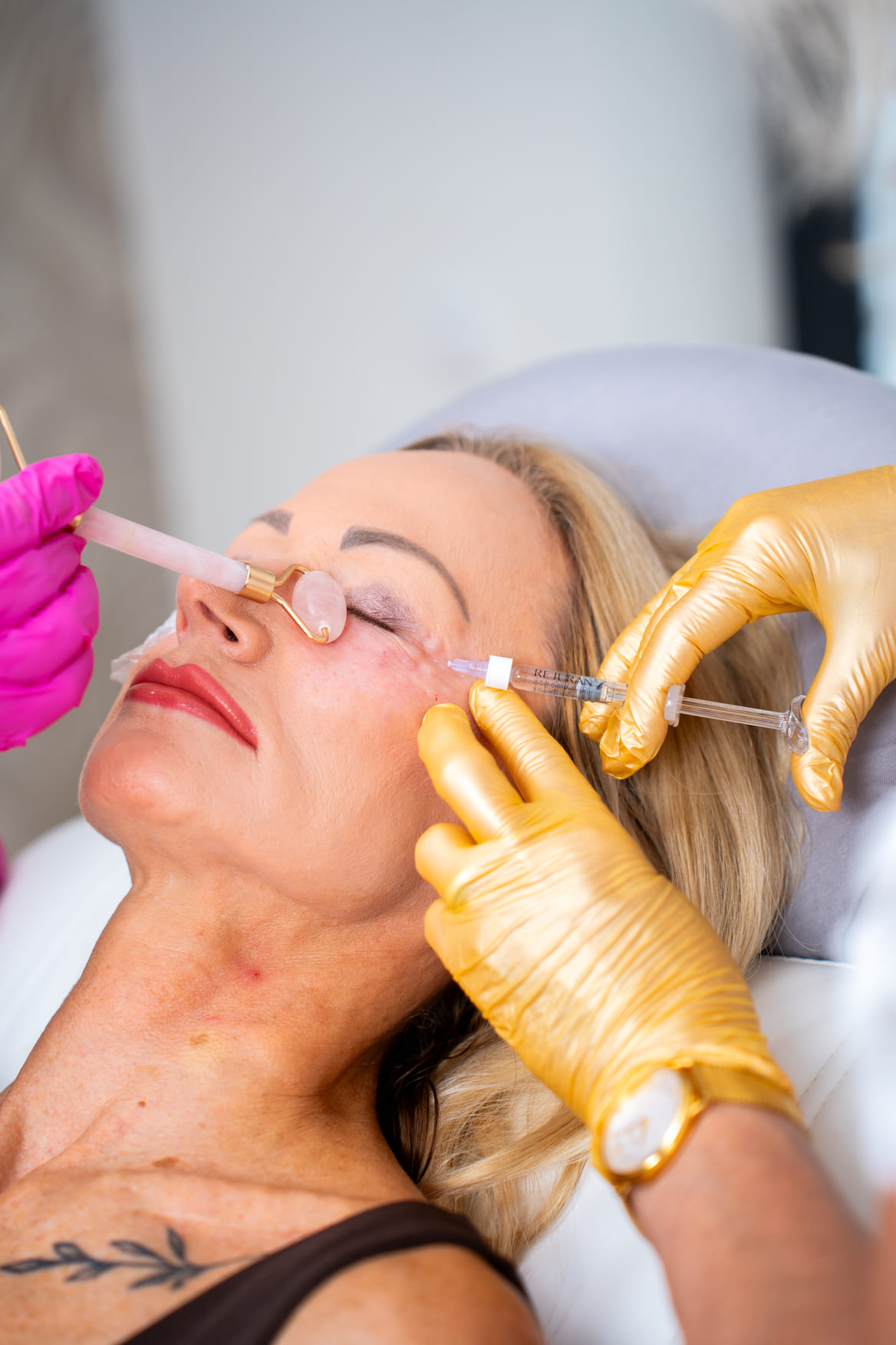 Biostimulace pleti Rejuran v LE CLINIC