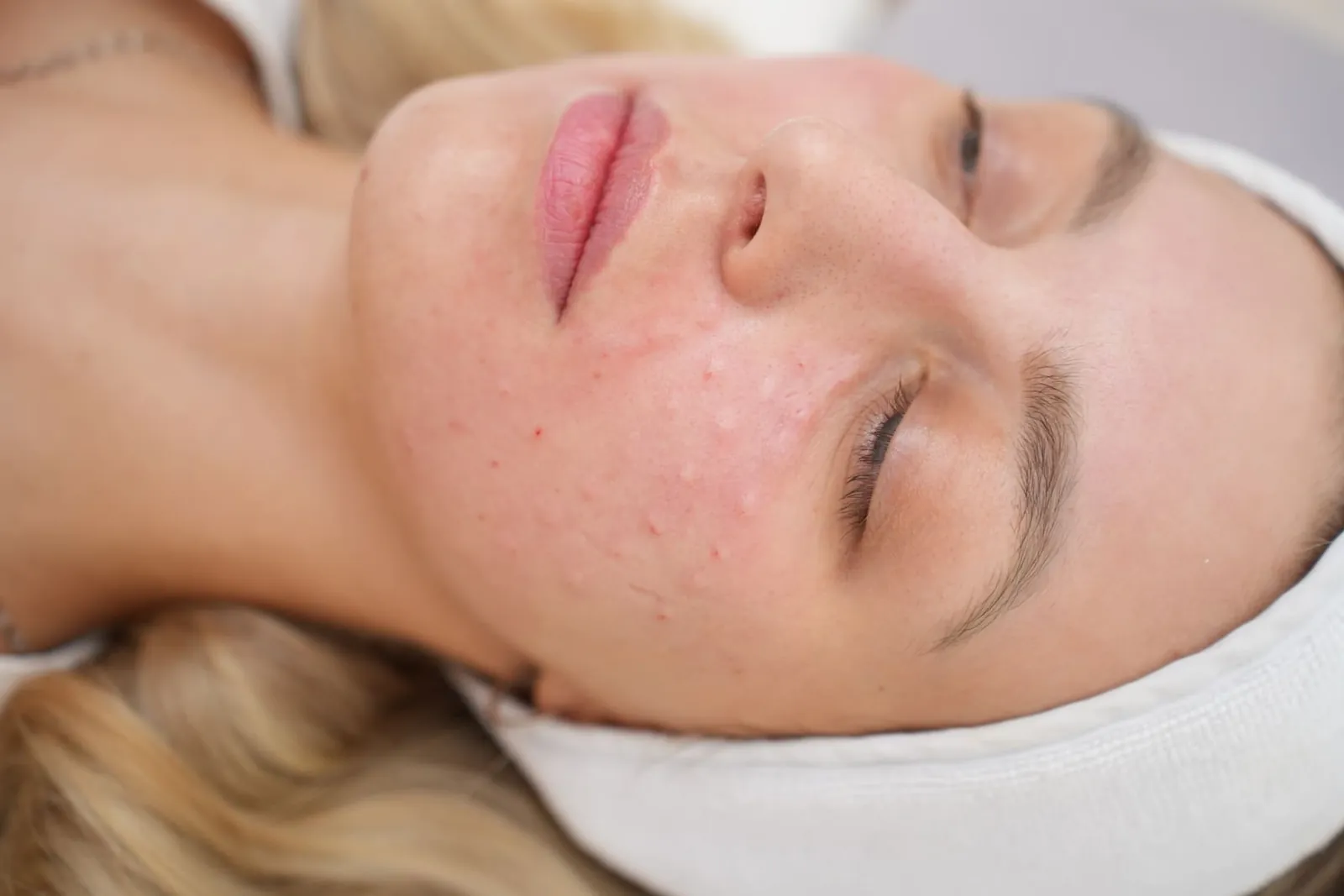 Klientka odpočívá po biostimulačním ošetření pleti