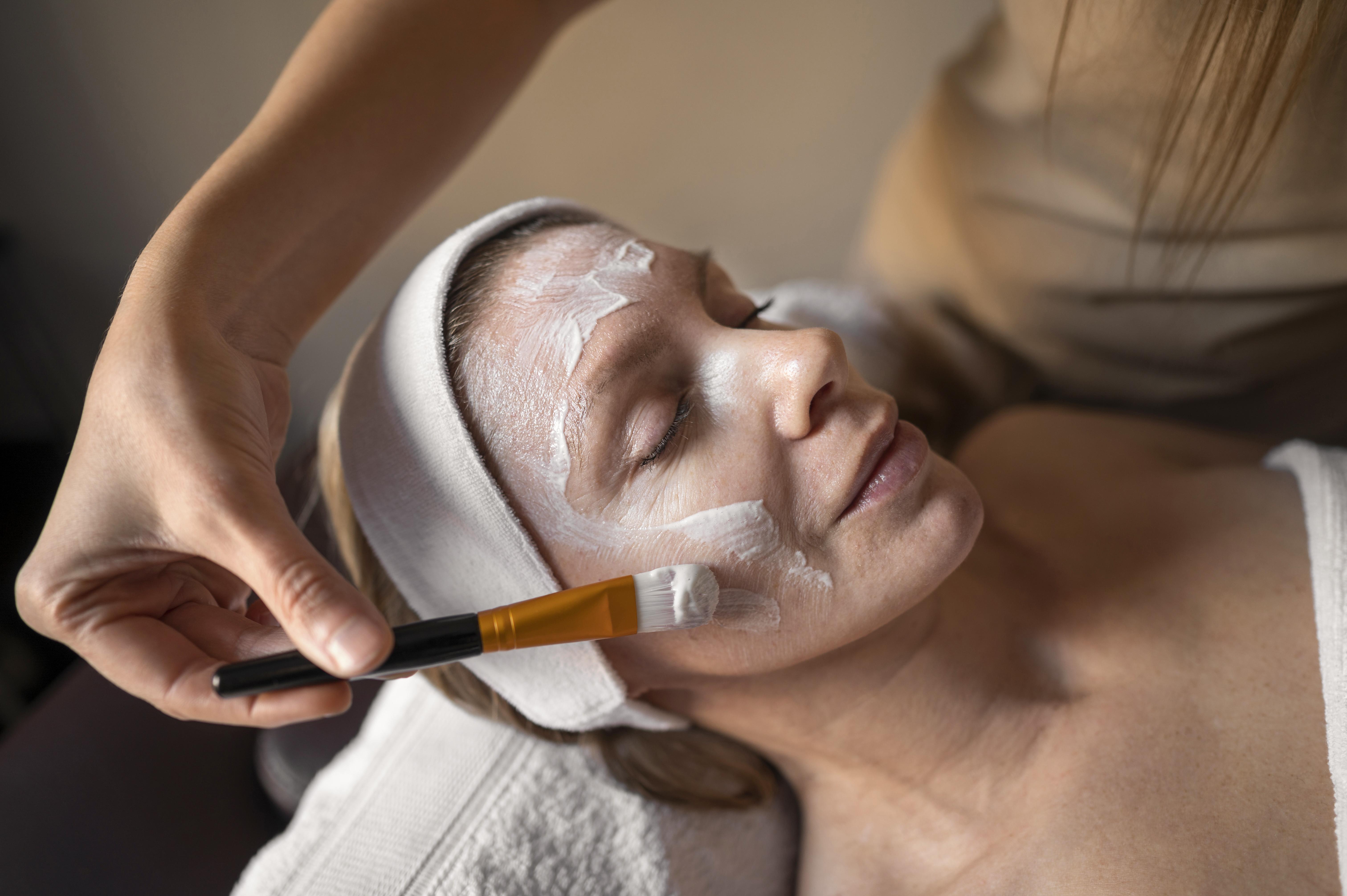 chemische peeling huidverbetering egalere huid wassenaar