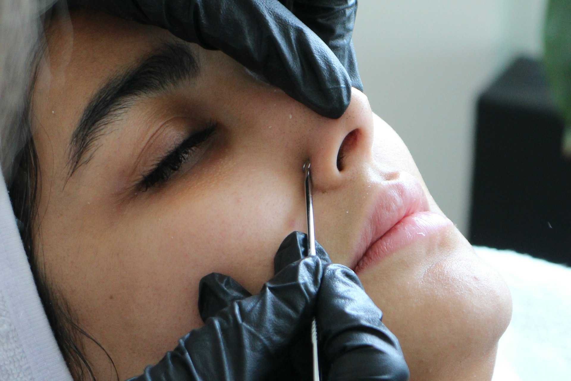 Injection à la base du nez, sous la pointe relevée par la main du praticien