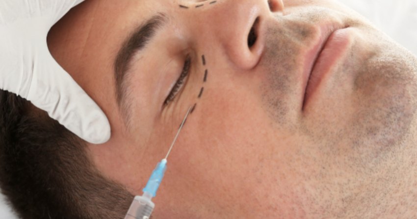 Injection dans le creux du cerne, sous l'œil, le long d'un tracé au crayon