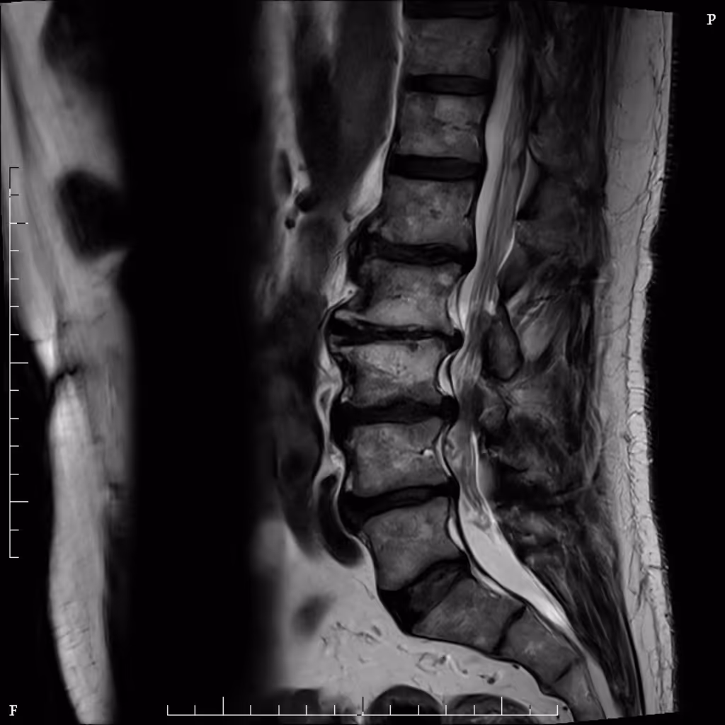 a scan of a spine and back