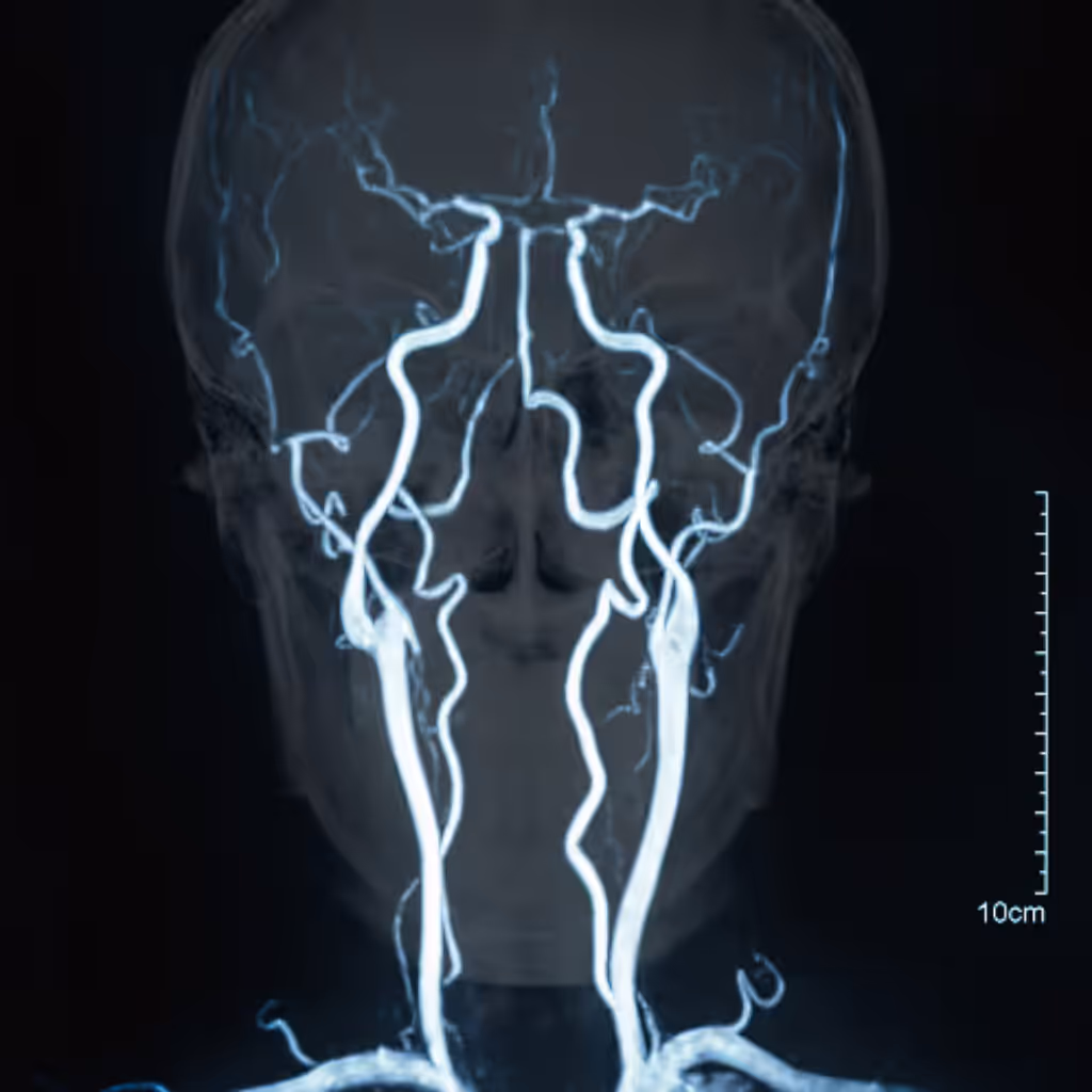 a scan of a brain