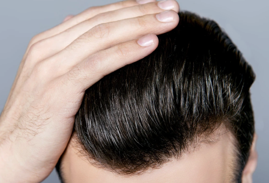 Greffe de cheveux durable à vie - Maison Apogée