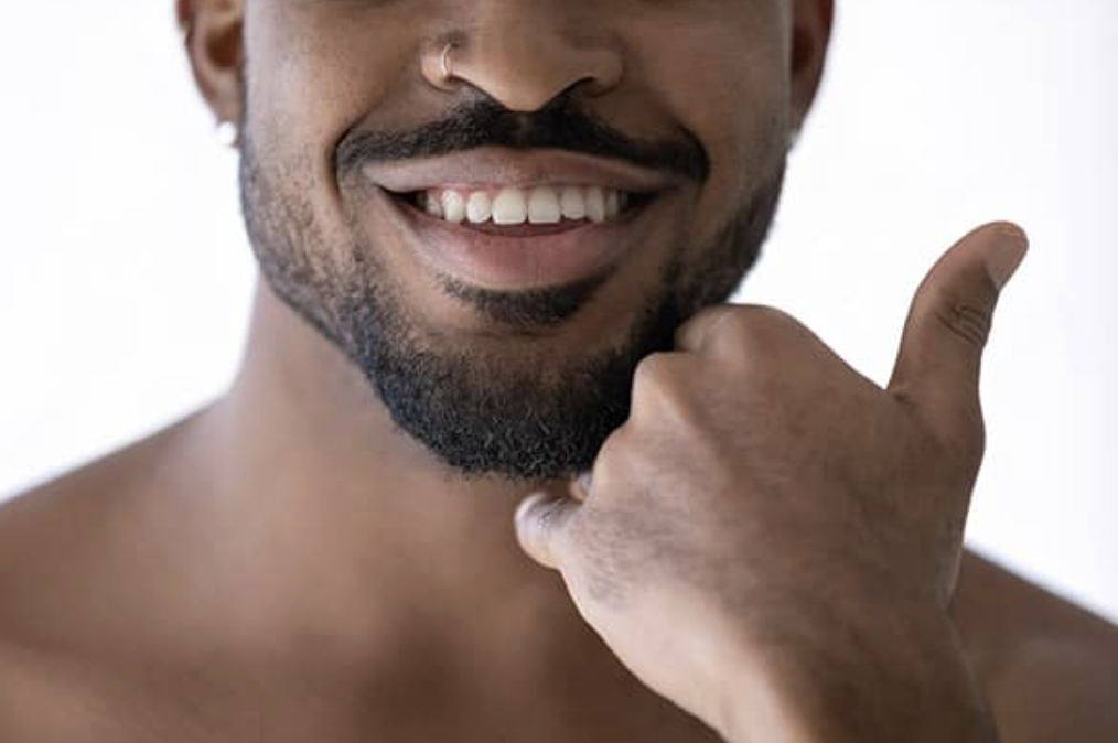 Micro-greffe barbe clairsemée - Maison Apogée