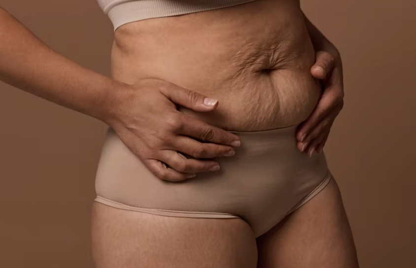 Raffermir peau sans chirurgie technologie - Maison Apogée