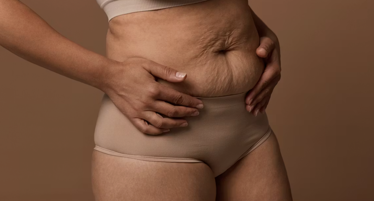 Diastasis et fermeté abdominale solutions - Maison Apogée