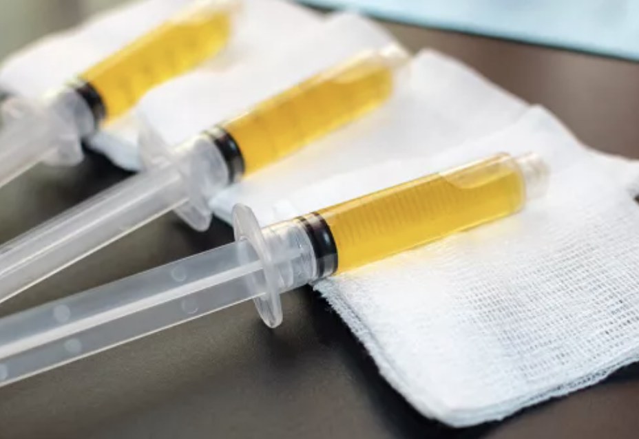 PRP plasma riche en plaquettes peau cheveux - Maison Apogée