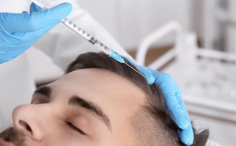 Greffe de cheveux densité naturel confiance Apogée