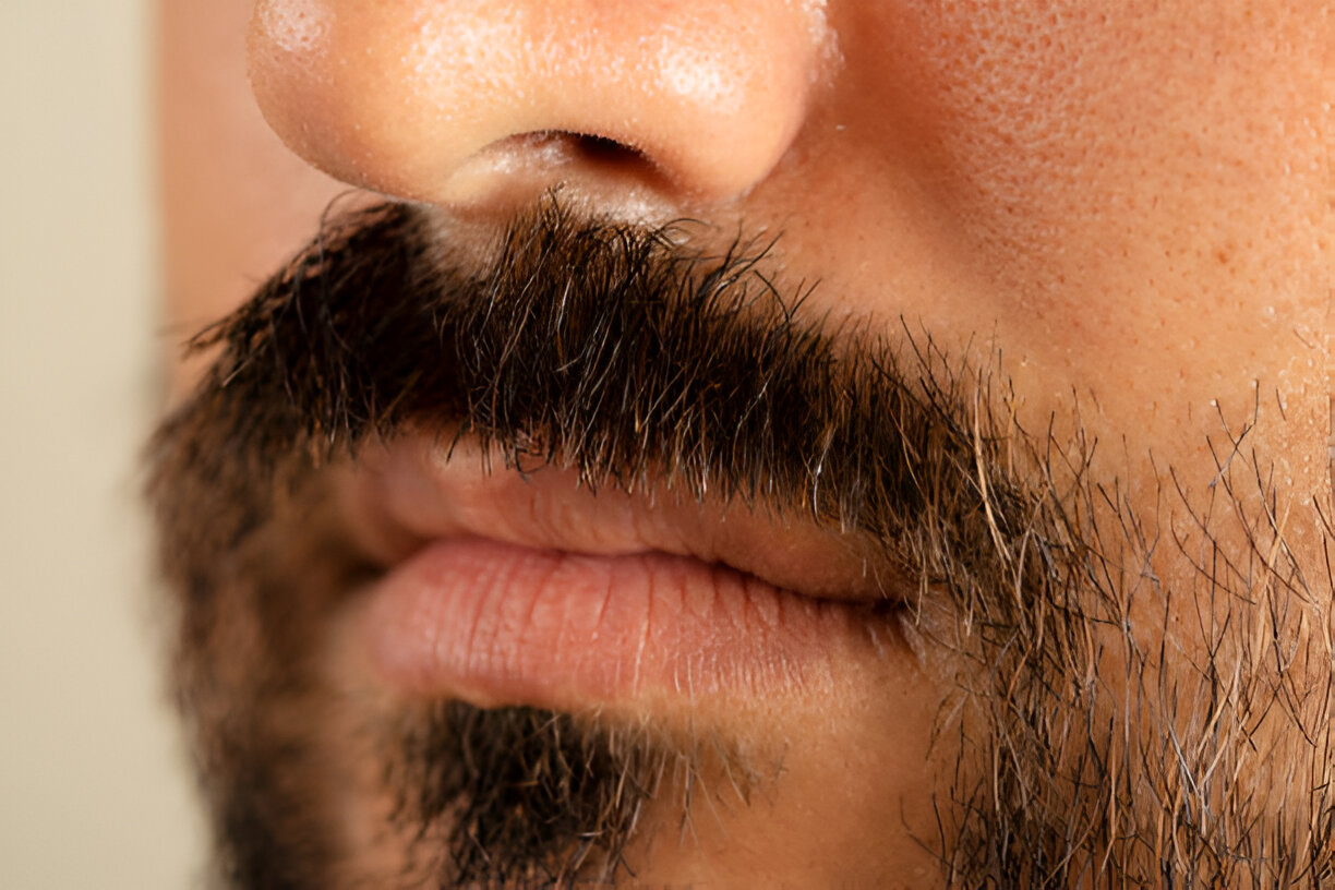 Repousse après greffe de barbe - Maison Apogée