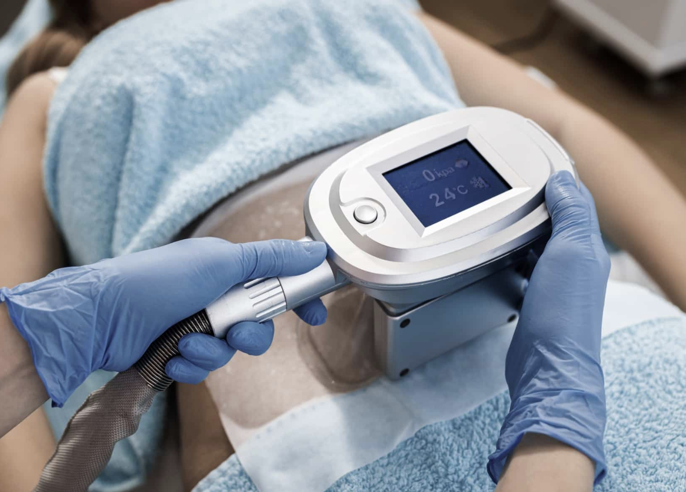 CoolSculpting Apogée Paris traitement
