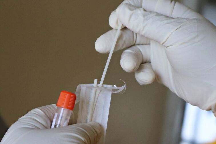 Neden Doğum Öncesi DNA Testi Yaptırmalısınız?