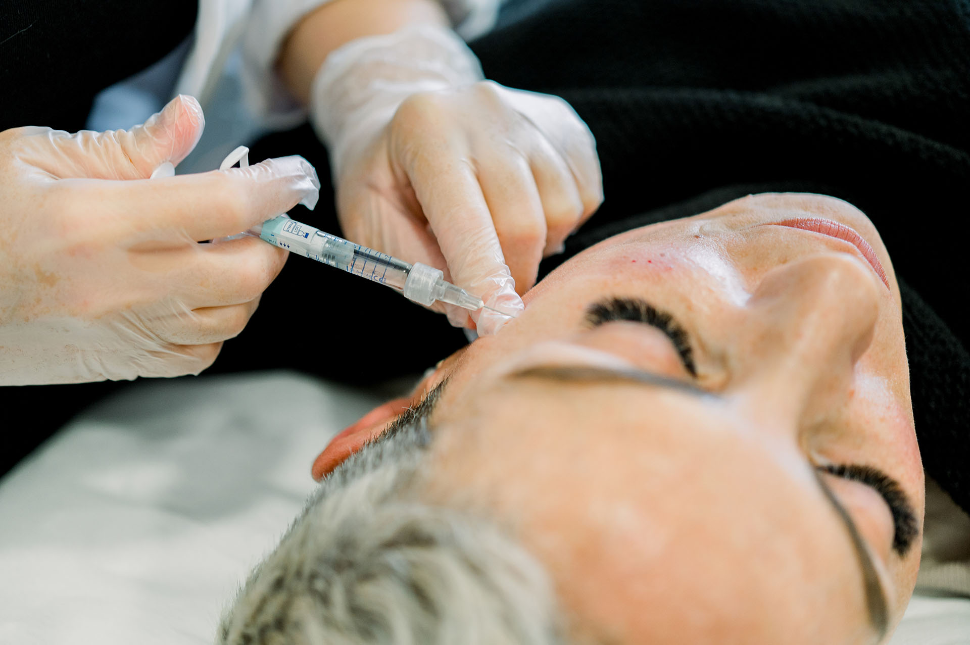 Cosmetic facial treatment with dermal fillers in a clinic