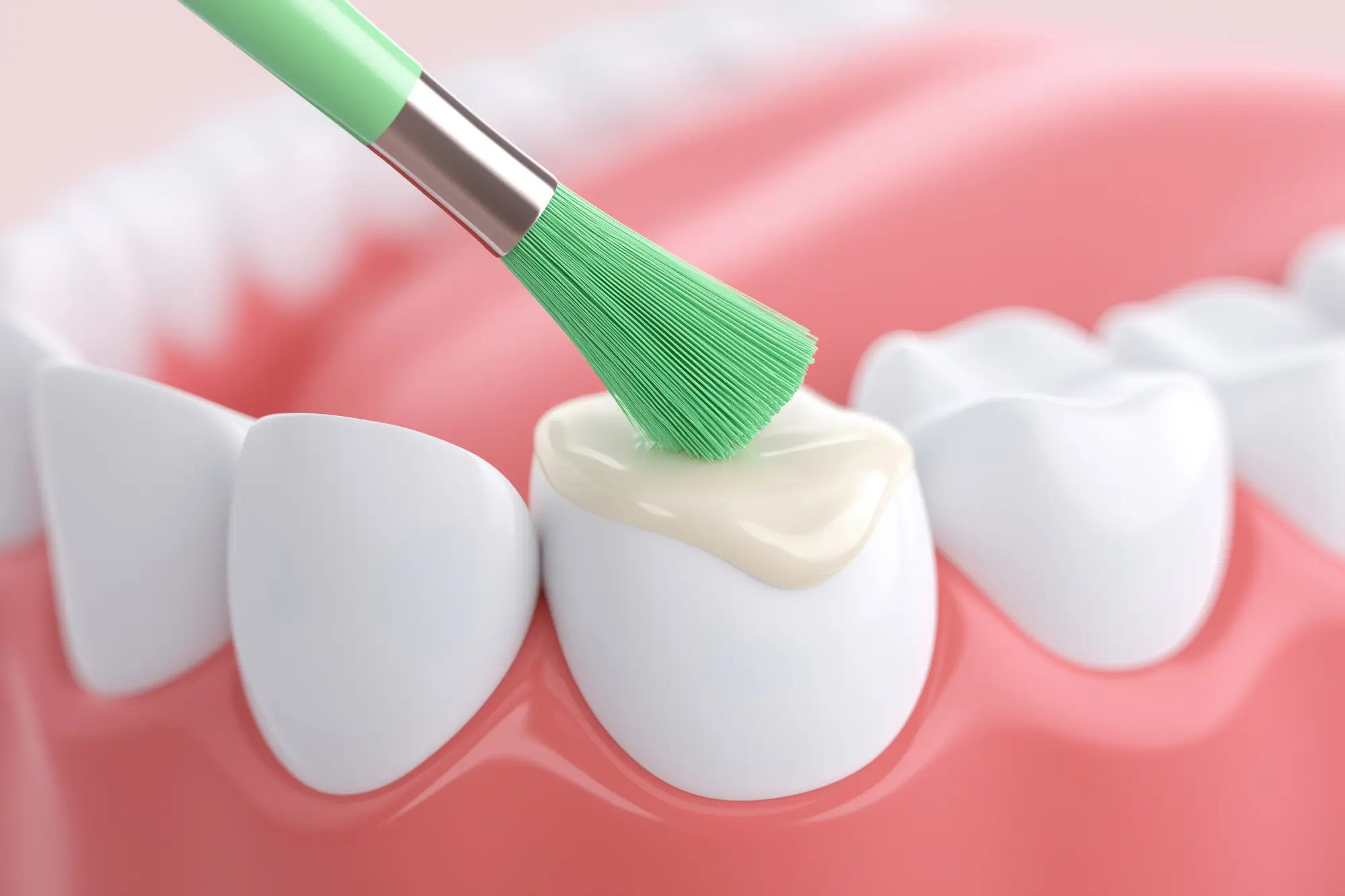 Fluoride Treatments in Owings Mills, MD | New Town Dental