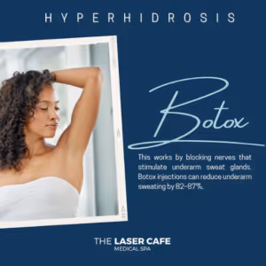 Botox Hyperhidrosis San Diego