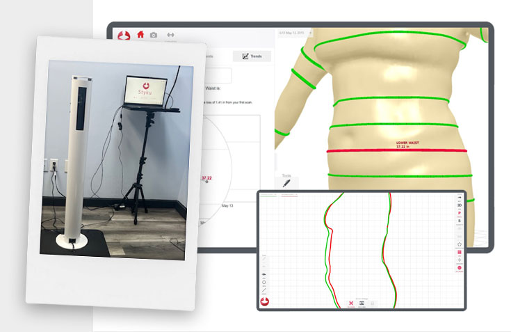 3D Weight loss Model