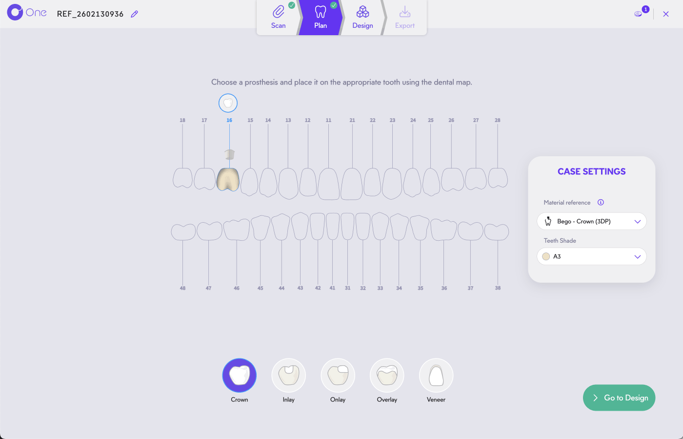 Circle One selection des prothèses dentaires sur les arcades dentaires