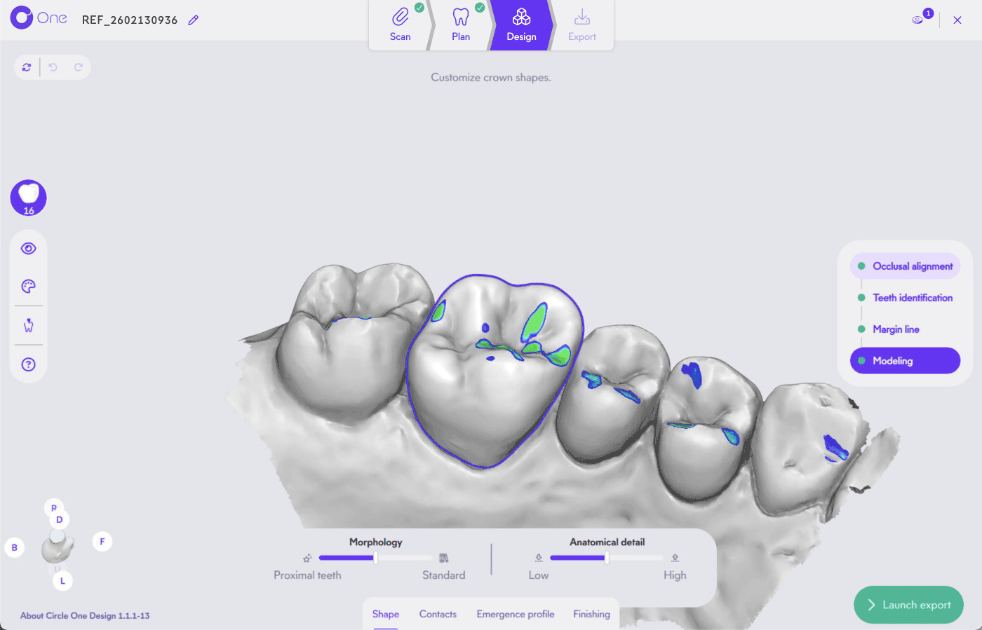 Circle One gestion de l'esthétique des prothèses dentaires