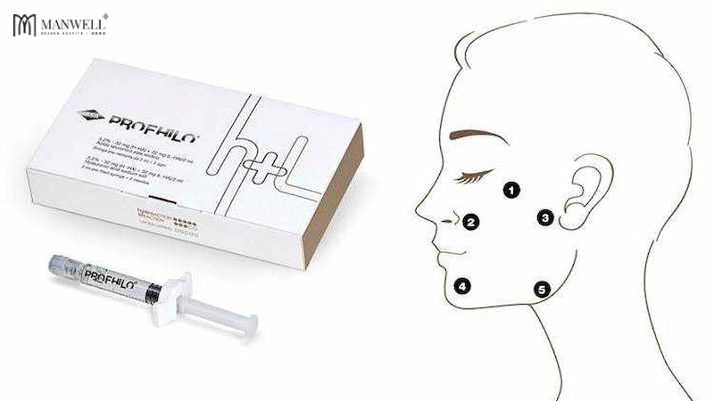 Profhilo là sản phẩm được ứng dụng phổ biến trong kỹ thuật tiêm B.A.P 5 điểm bởi hàm lượng HA dồi dào của nó.
