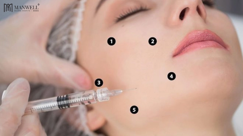 Tiêm BAP giúp trẻ hoá vùng da chảy xệ, chùng nhão